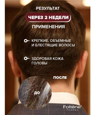 FOLTENE Pharma Shampoo for the growth of hair male Saluscapular therapeutic - Buy Online on GoSupps.com