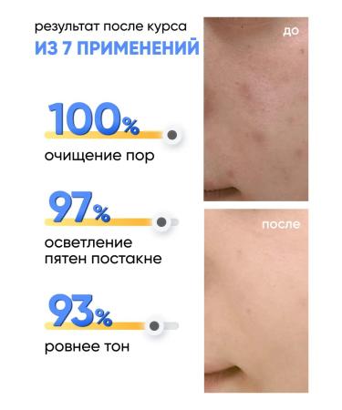 Lefami Facial peeling - Buy Online on GoSupps.com