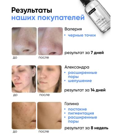 Lefami Facial peeling - Buy Online on GoSupps.com