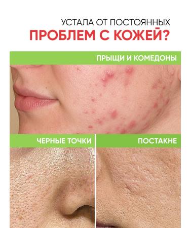 Lefami Permis from acne and black dots for skin and body skin - Buy Online on GoSupps.com