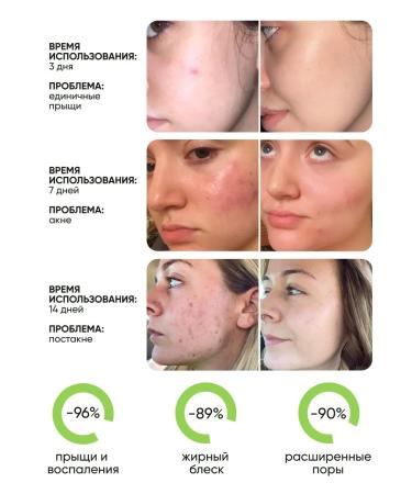 Lefami Permis from acne and black dots for skin and body skin - Buy Online on GoSupps.com