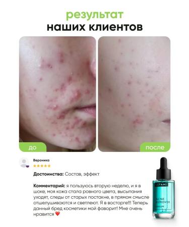 Lefami Permis from acne and black dots for skin and body skin - Buy Online on GoSupps.com