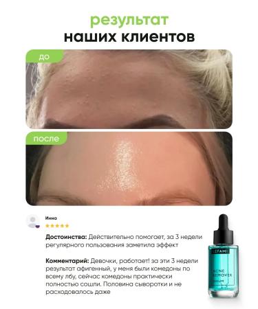 Lefami Permis from acne and black dots for skin and body skin - Buy Online on GoSupps.com
