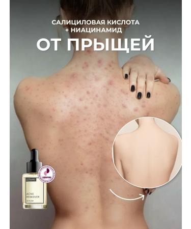 Lefami Acne and acne serum