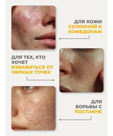 Lefami Acne and acne serum - Buy Online on GoSupps.com