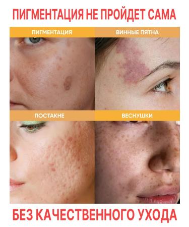 Lefami Serum for aligning the skin tone and post -acne - Buy Online on GoSupps.com