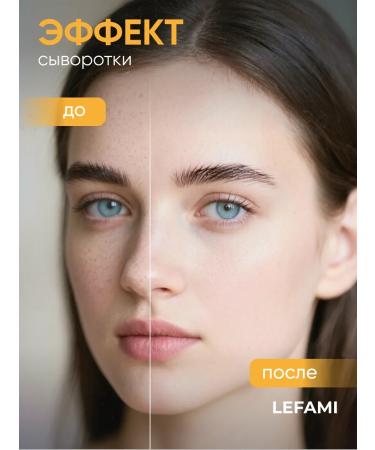 Lefami Serum for aligning the skin tone and post -acne - Buy Online on GoSupps.com