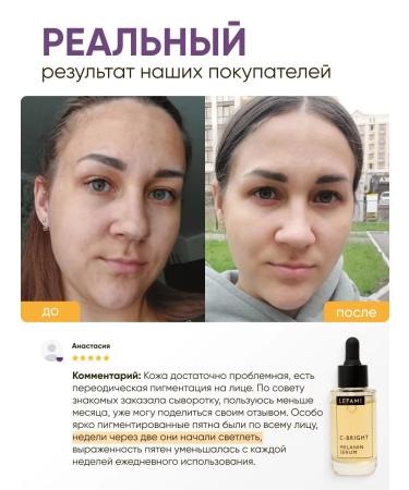 Lefami Serum for aligning the skin tone and post -acne - Buy Online on GoSupps.com
