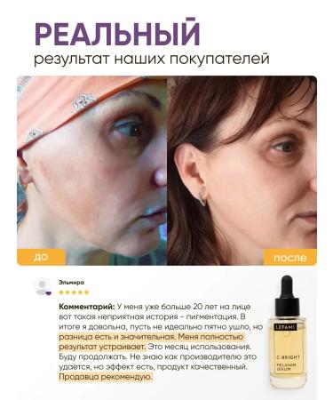 Lefami Serum for aligning the skin tone and post -acne - Buy Online on GoSupps.com