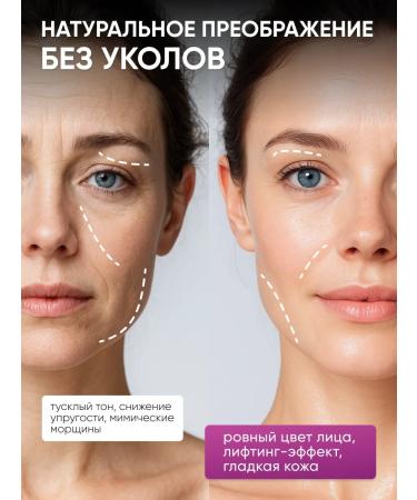 Lefami Serum from wrinkles for the skin of the face anti -aging - Buy Online on GoSupps.com