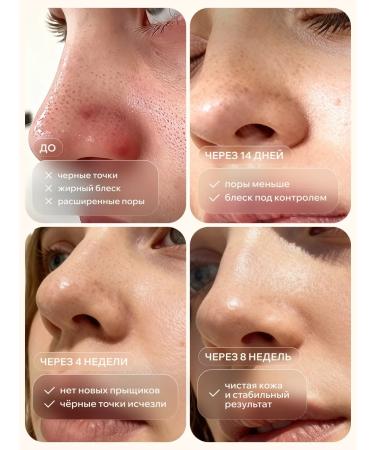 KEYCLEAR Serum for narrowing pores - Buy Online on GoSupps.com