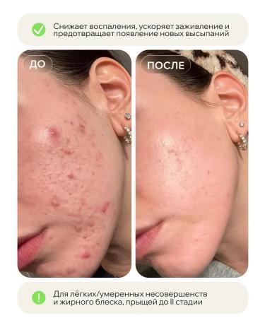 KEYCLEAR Serum for narrowing pores - Buy Online on GoSupps.com