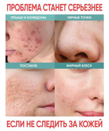 KEYCLEAR Facial serum from acne from black dots - Buy Online on GoSupps.com