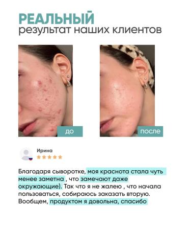 KEYCLEAR Facial serum from acne from black dots - Buy Online on GoSupps.com