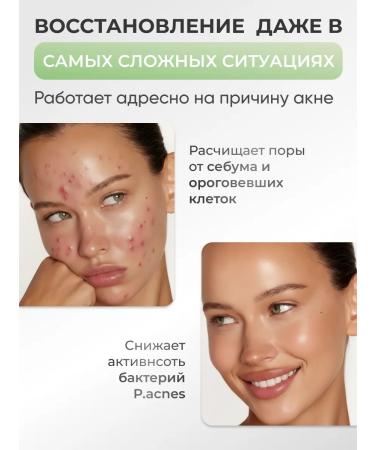 Lefami Close and face acne with salicylic acid - Buy Online on GoSupps.com