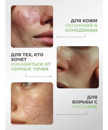 Lefami Close and face acne with salicylic acid - Buy Online on GoSupps.com