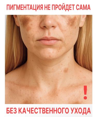 KEYCLEAR Serum vitamin C and peptides against pigmentation and post -acne - Buy Online on GoSupps.com