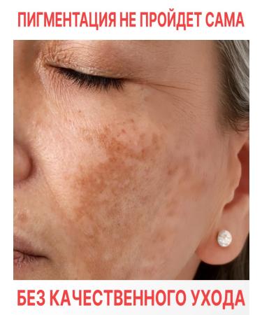 Lefami Wedeously for the face from post -acne and acne with niacinamide - Buy Online on GoSupps.com