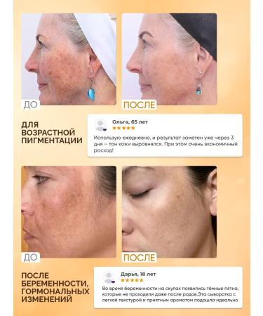 Lefami Wedeously for the face from post -acne and acne with niacinamide - Buy Online on GoSupps.com