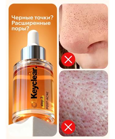 KEYCLEAR Facial serum from acne and black dots - Buy Online on GoSupps.com