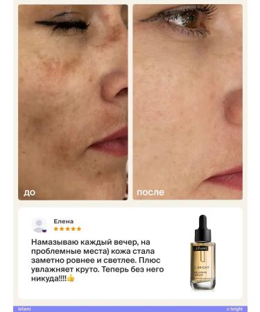 Lefami Whitening cream serum for an intimate zone and face - Buy Online on GoSupps.com