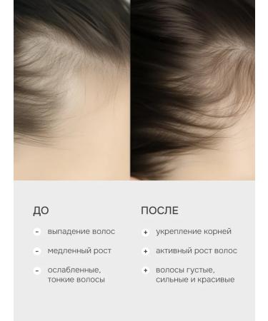 levrana Hair growth with rosemary strengthening 200 ml - Buy Online on GoSupps.com