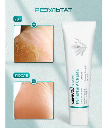 Gehwol Cream from cracks on the heels of blue balm - Buy Online on GoSupps.com