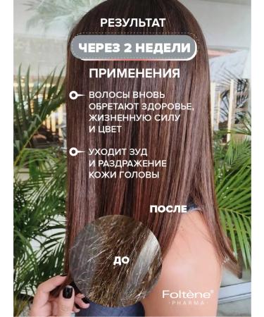 FOLTENE Pharma  - Buy Online on GoSupps.com