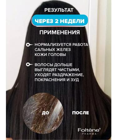 FOLTENE Pharma Shampoo for oily hair Salusculuscous professional - Buy Online on GoSupps.com