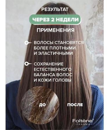 FOLTENE Pharma Hair shampoo Saluscapular professional therapeutic - Buy Online on GoSupps.com