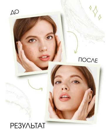 Matsesta Acne tonic for oily problem - Buy Online on GoSupps.com