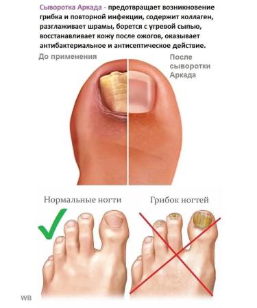 Arcade Arkada Nail Wastee Serum TC16 - Buy Online on GoSupps.com