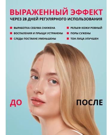 LAB Facial acne cream 50ml - Buy Online on GoSupps.com