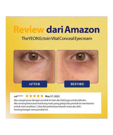 TheYEON Eye cream against dark circles and swelling 20 ml - Buy Online on GoSupps.com