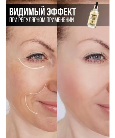 medi-peel Wheral with gold Luxury 24k Gold ampoule Korea - Buy Online on GoSupps.com