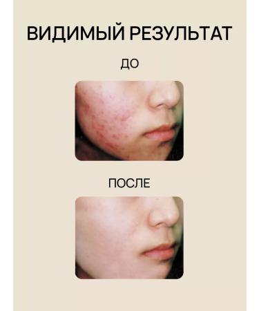 MUCH TOUCH Moisturizer to the face with niacinamide and vitamin C - Buy Online on GoSupps.com