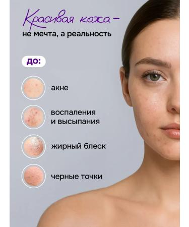 YeSiMi Penfa for washing the face of Korea from acne - Buy Online on GoSupps.com