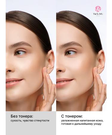YeSiMi Toner for the face against acne - Buy Online on GoSupps.com