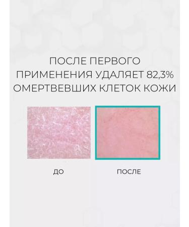 Derma:B Moisturizing shower gel from acne with acids - Buy Online on GoSupps.com