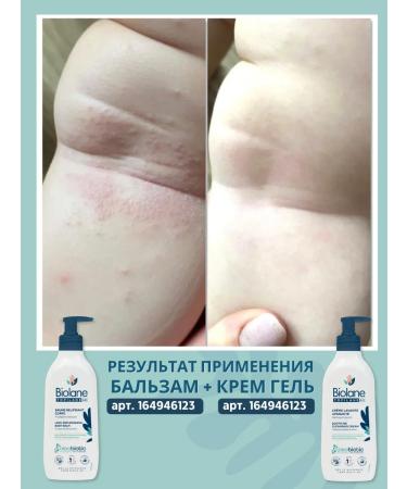 Biolane Moisturizing Emolat Cream for Facial and Body Topilane 0+ - Buy Online on GoSupps.com