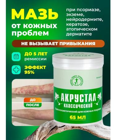 Acrustal Psoriasis ointment healing cream