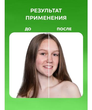 Floresan Mask Facial Piling Glycolic Rapid update 500ml 4sh - Buy Online on GoSupps.com