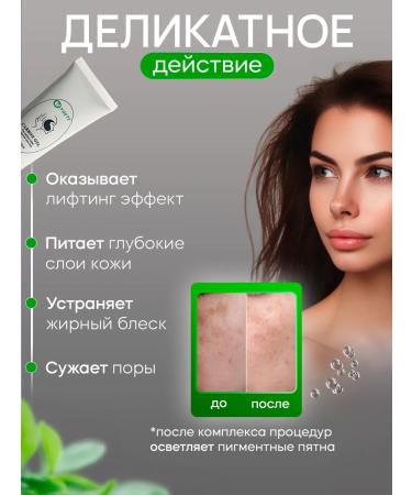 Taygete Carbon gel face peeling with laser - Buy Online on GoSupps.com