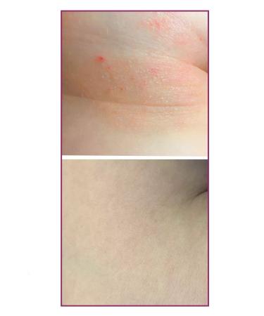 Rosilak Cream gel for skin and body - Buy Online on GoSupps.com