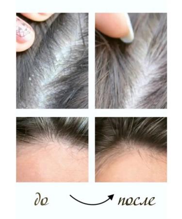 tianDe Shampoo and balm Golden Ginger Tianda - Buy Online on GoSupps.com