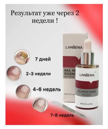 LANBENA Nail fungus treatments - Buy Online on GoSupps.com