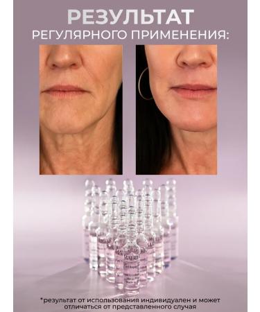 Matrigen Anti -aging serum for the face. Fluids 20 pcs - Buy Online on GoSupps.com