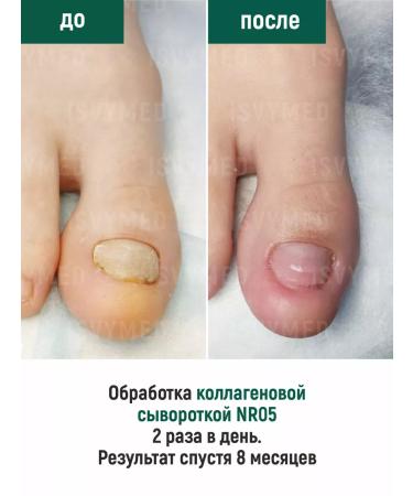 ISVYMED Collagen serum for nails - Buy Online on GoSupps.com