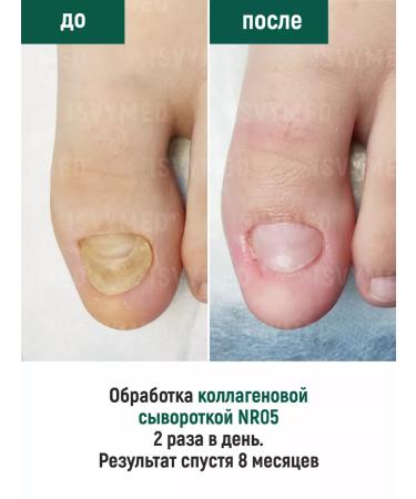 ISVYMED Collagen serum for nails - Buy Online on GoSupps.com