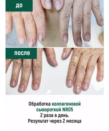 ISVYMED Collagen serum for nails - Buy Online on GoSupps.com